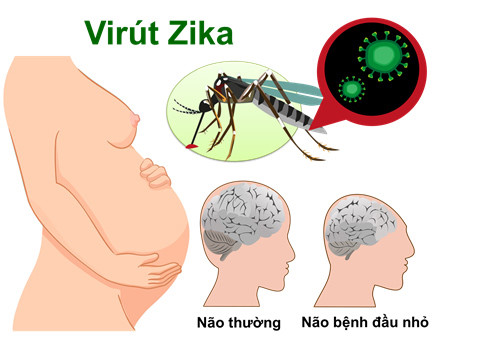 virut-zika-khi-mang-thai
